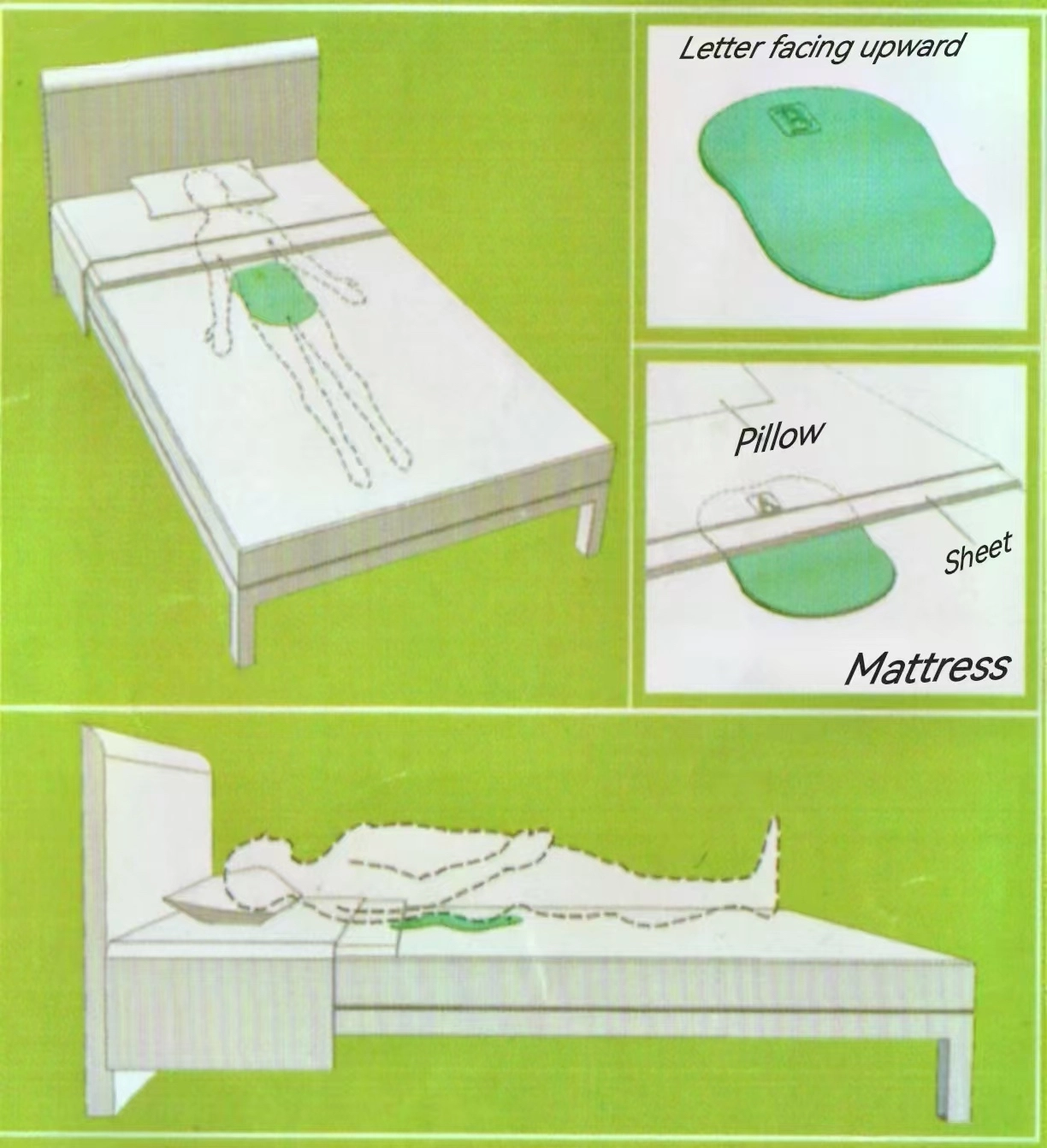 How to position the Lumbosacral Curve External Fixator beneath the lumbar region on a soft mattress