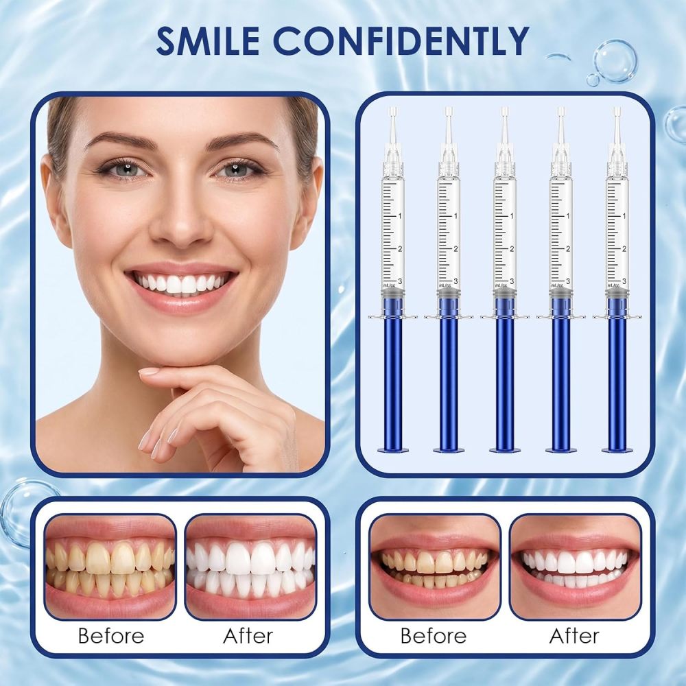 15 Pcs teeth whitening gel  35%cp peroxide