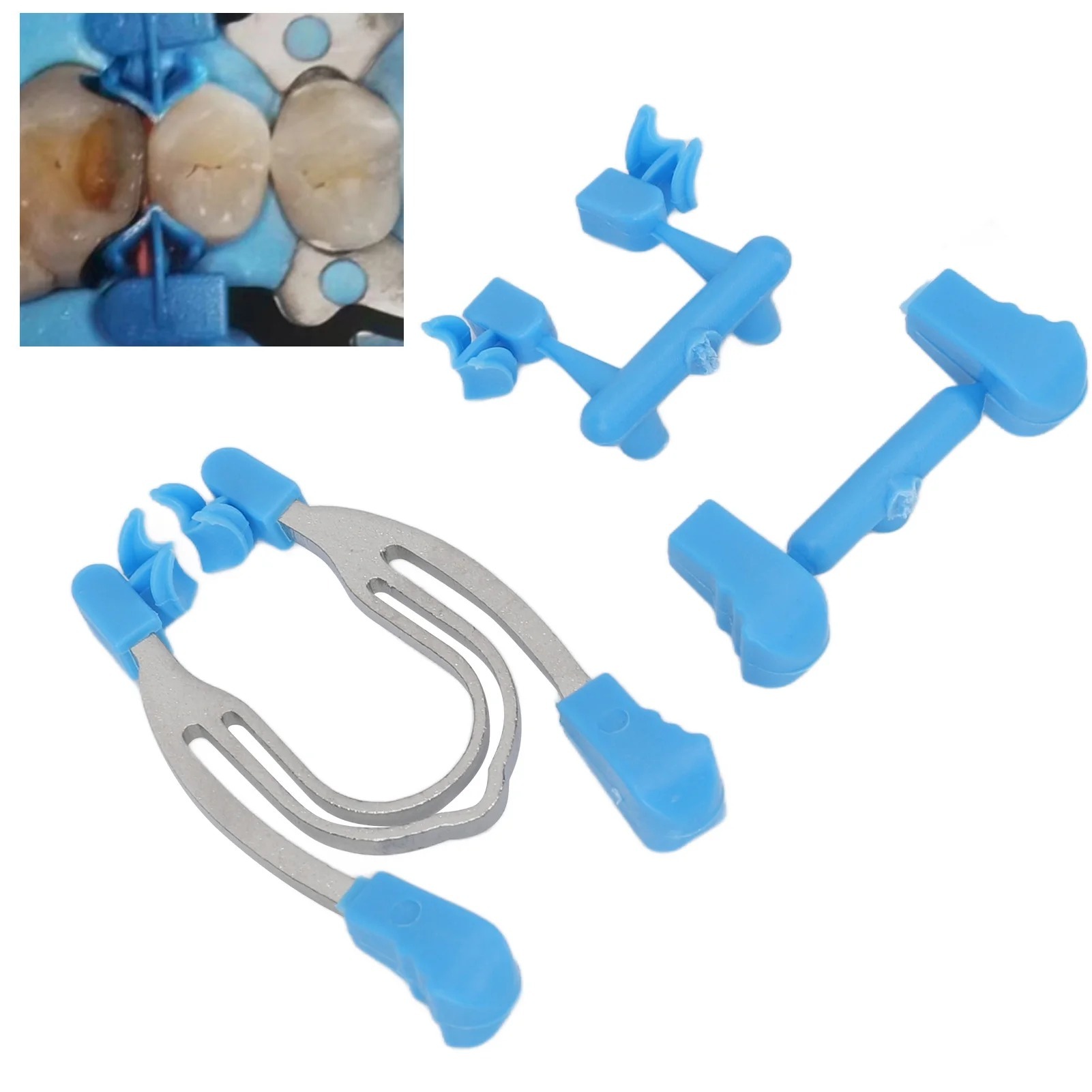 2PCS Dental Sectional Contoured Matrices Clip Set High Temperature Resistant Clamp for Hospital Teeth Dental Matrices Clamp