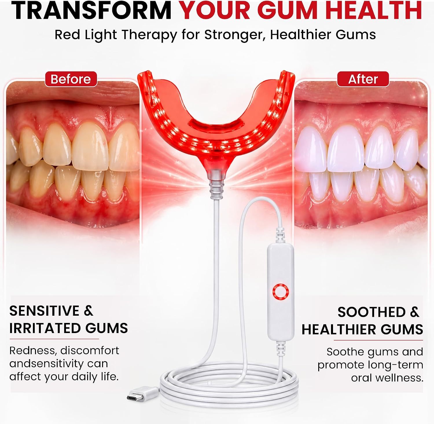 Red Light for Gums – Gum Health & Gum Care – 32 Red LEDs for Gums and Teeth – USB-C, USB & Lightning-Compatible Adapters Included Packed by high Quality Storage case