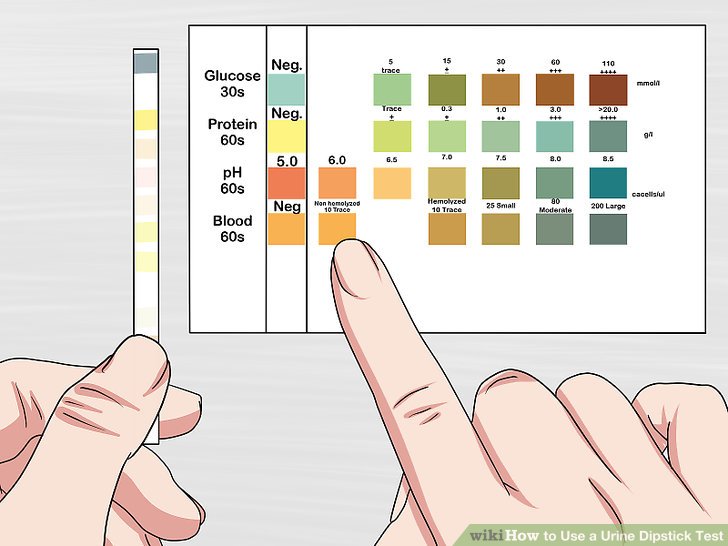 Тест на мочу. Анализ мочи Dipstick. Dipstick Test. Dorsalgia urine Dipstick. Dipstick Test means.